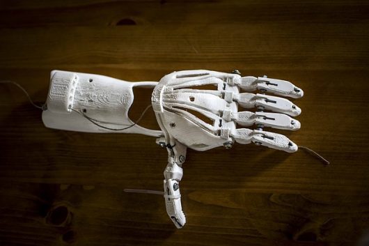3-D-Printed Prosthetic Limbs