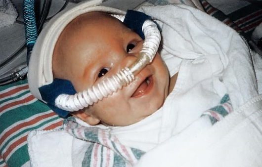CPAP-Machine-for-Newborns