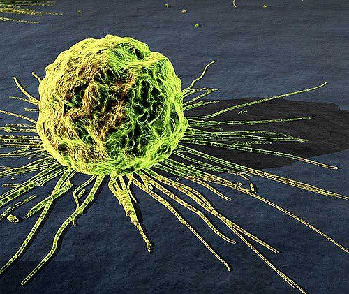 Cancer in Resource-Poor Countries
