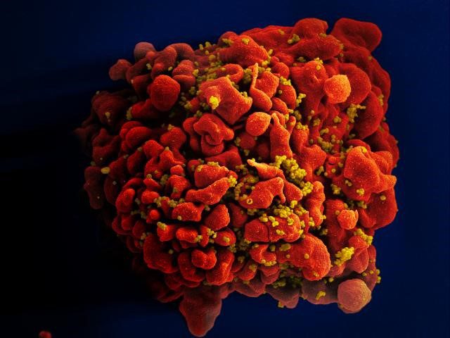 Cure for HIV