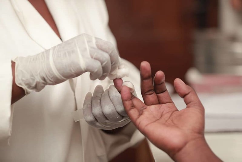 Global HIV Infections and Deaths Are Declining