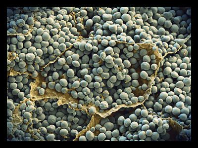 Can Converting Cellulose Into Starch Solve World Hunger?