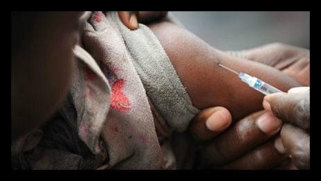Measles Eradication