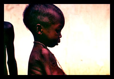 Maternal and Child Nutrition