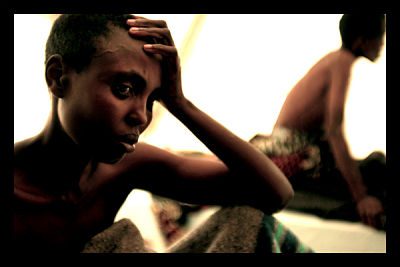 malnutrition